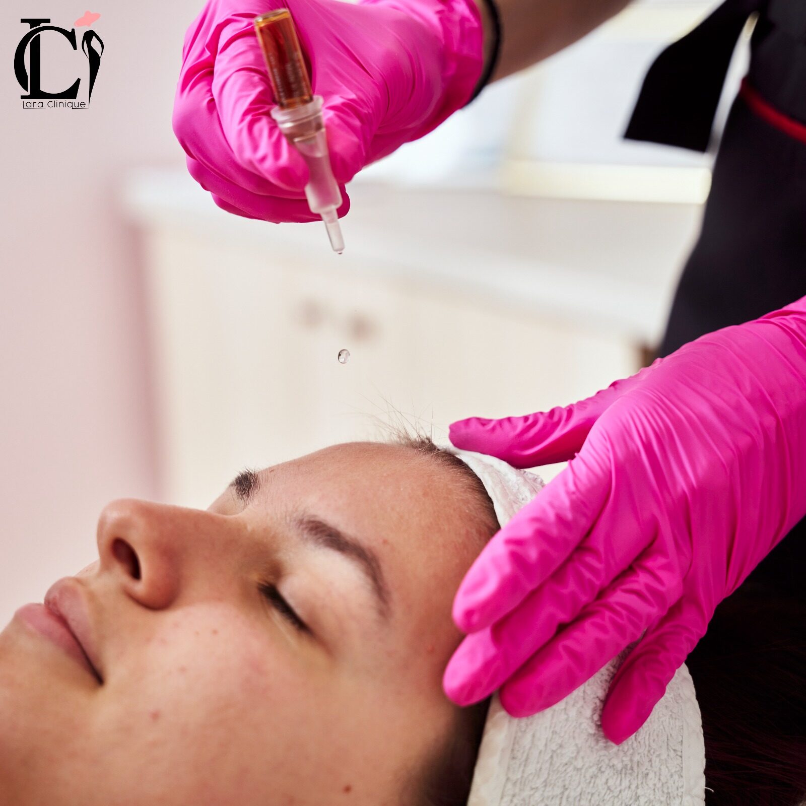 Bio-Microneedling O'Care — Lara Clinique Fălticeni